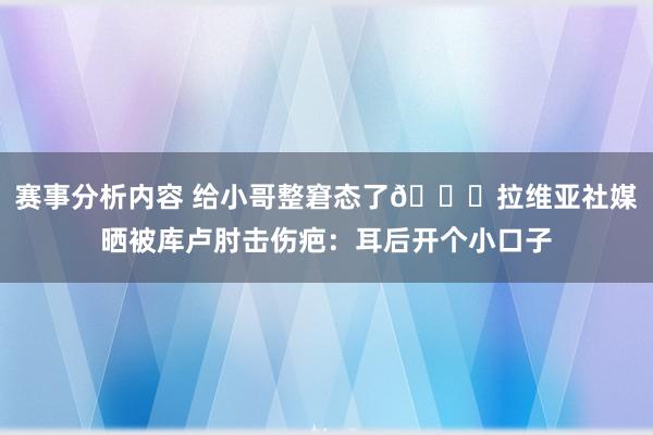 赛事分析内容 给小哥整窘态了😅拉维亚社媒晒被库卢肘击伤疤：耳后开个小口子